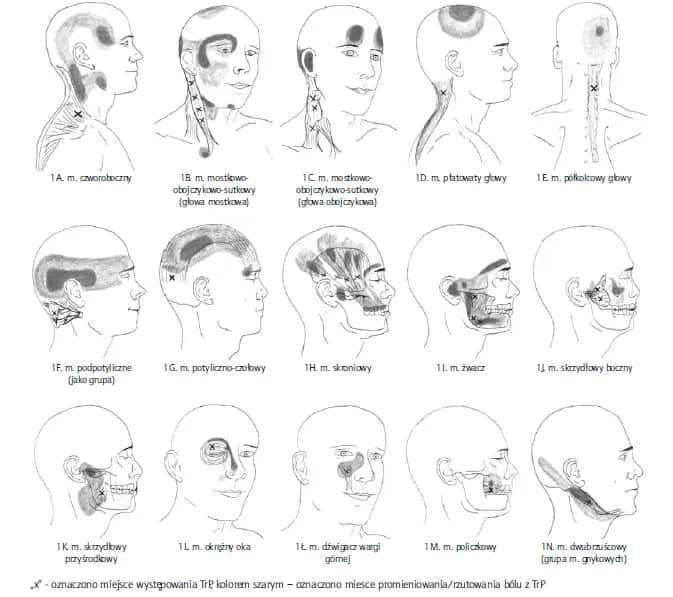 Skuteczne metody leczenia napięciowego bólu głowy i ulga w bólu