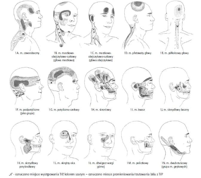 Skuteczne metody leczenia napięciowego bólu głowy i ulga w bólu