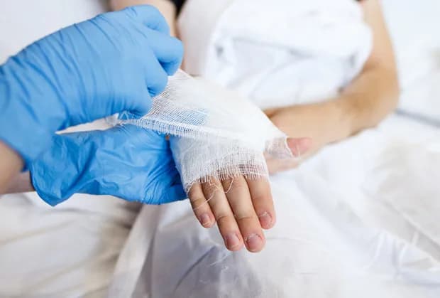 Kiedy zacząć rehabilitację po operacji cieśni nadgarstka, aby uniknąć bólu?