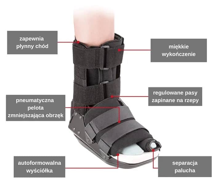 Kiedy normalne buty po operacji haluksa? Sprawdź, aby uniknąć bólu