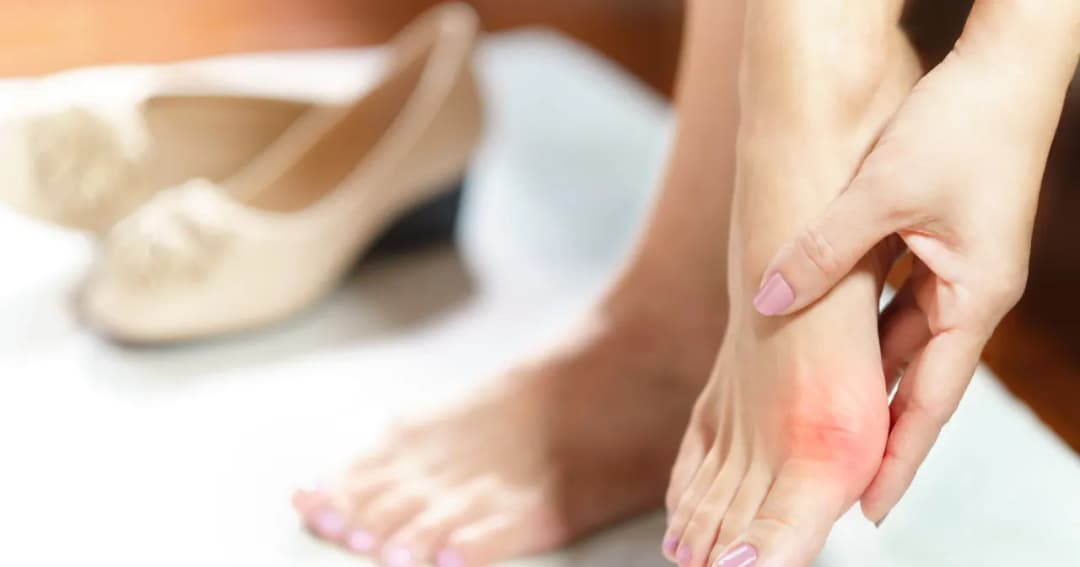 Jak uniknąć haluksów: skuteczne sposoby na zdrowe stopy