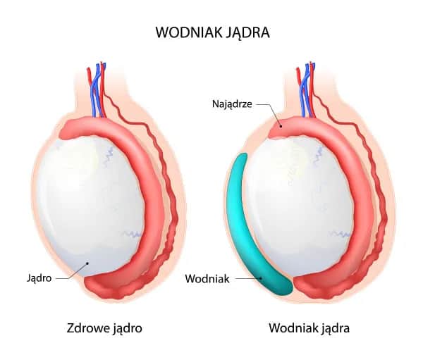 Ból jądra jaki lekarz – jak szybko uzyskać pomoc medyczną?