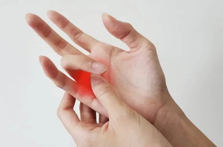 Jak skręcić rękę: skuteczne metody leczenia i objawy do obserwacji