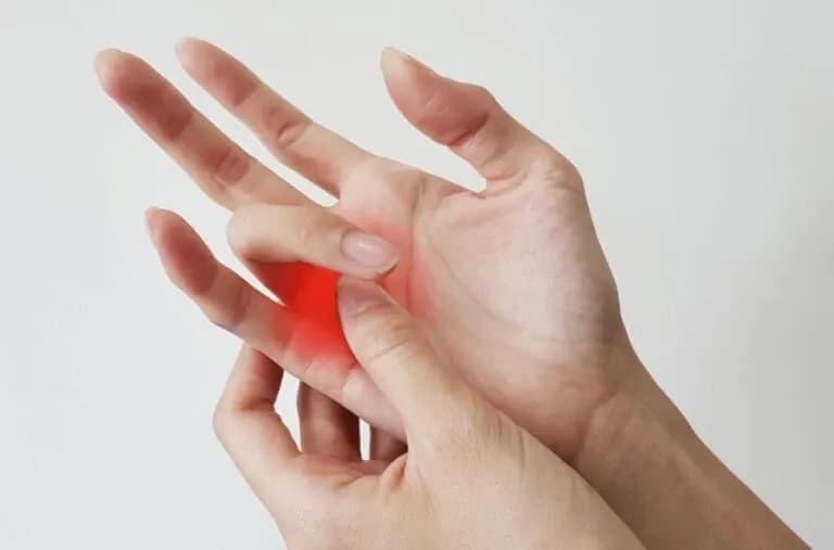 Jak skręcić rękę: skuteczne metody leczenia i objawy do obserwacji