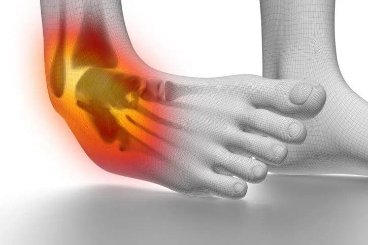 Czy skręcenie kostki boli? Objawy i sposoby na złagodzenie bólu