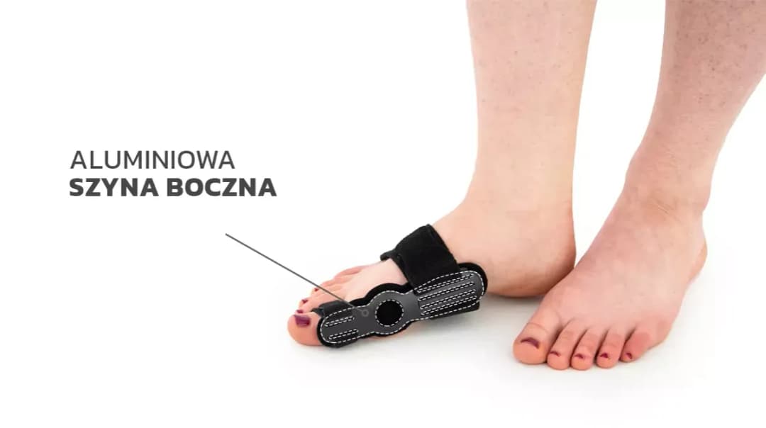 Czy ortezy na haluksy działają? Odkryj ich prawdziwe efekty