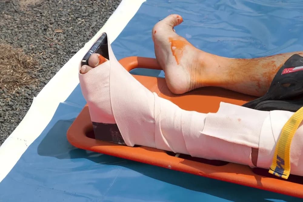 Jak skręcić nogę i uniknąć bólu - konsekwencje samookaleczenia