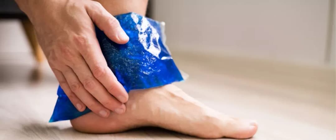 Skręcenie kostki co robić? Kluczowe kroki, aby uniknąć bólu i komplikacji